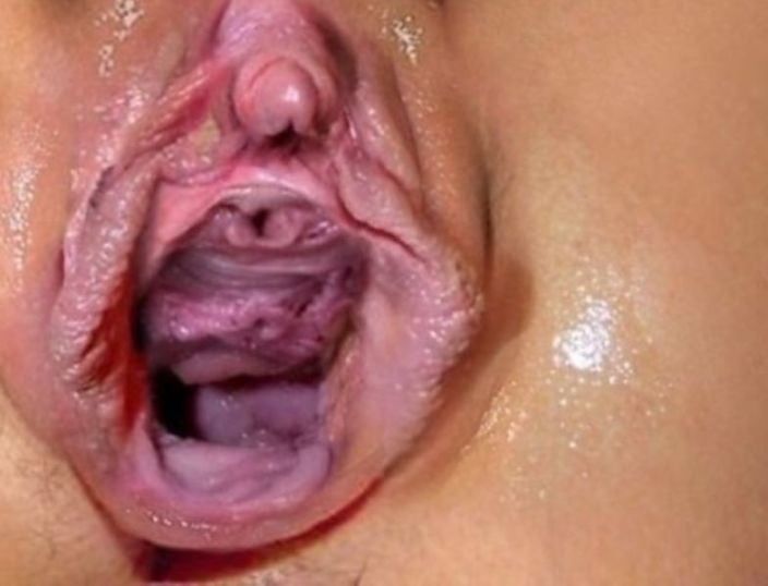 Gaping big pussy lips free porn images
