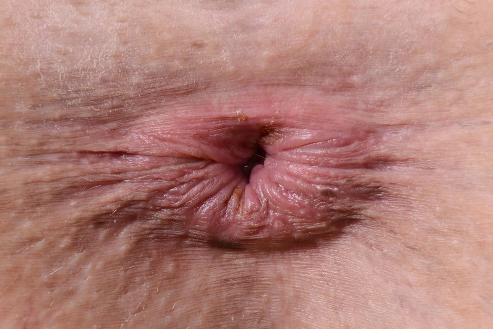 Анус и вагина крупным планом 68 фото