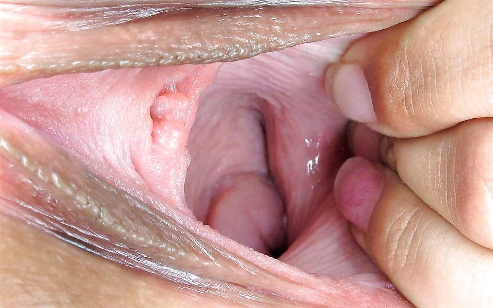 What Does A Healthy Vagina Look Like