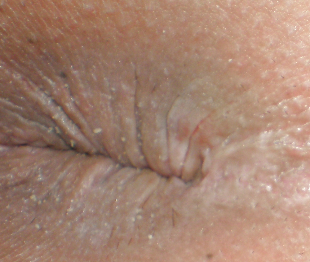 Porn image My 18 year old butthole (a few years ago)