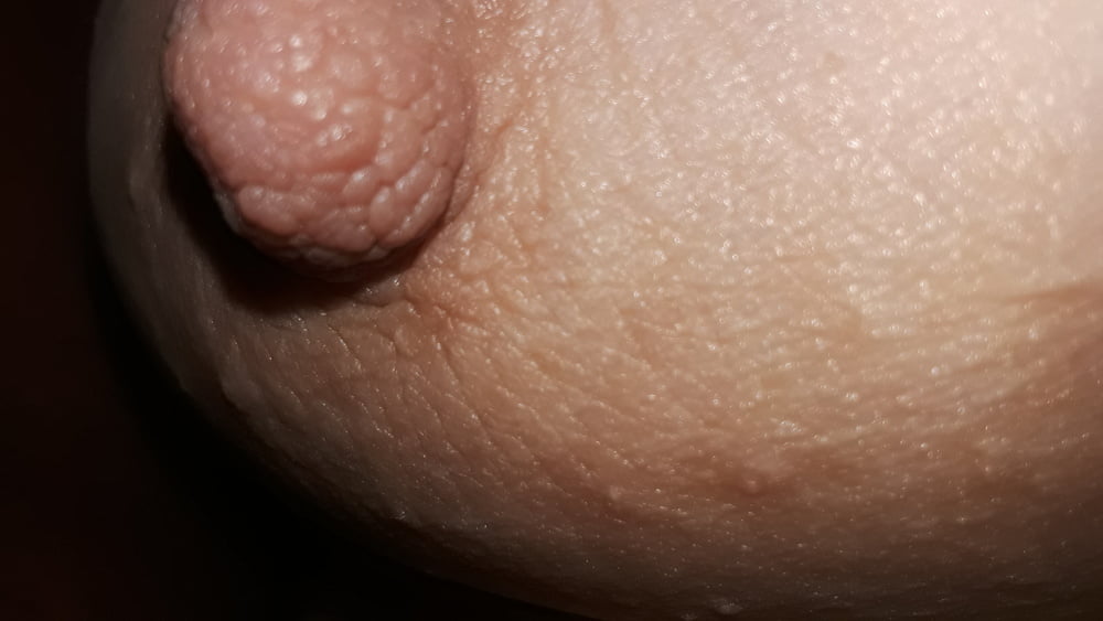Resting nipples - 30 Photos 