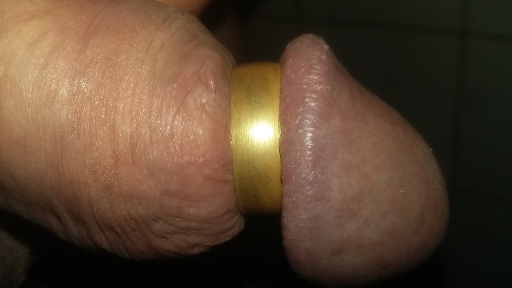 Penis And Hair Growth Update 45 Pics Xhamster