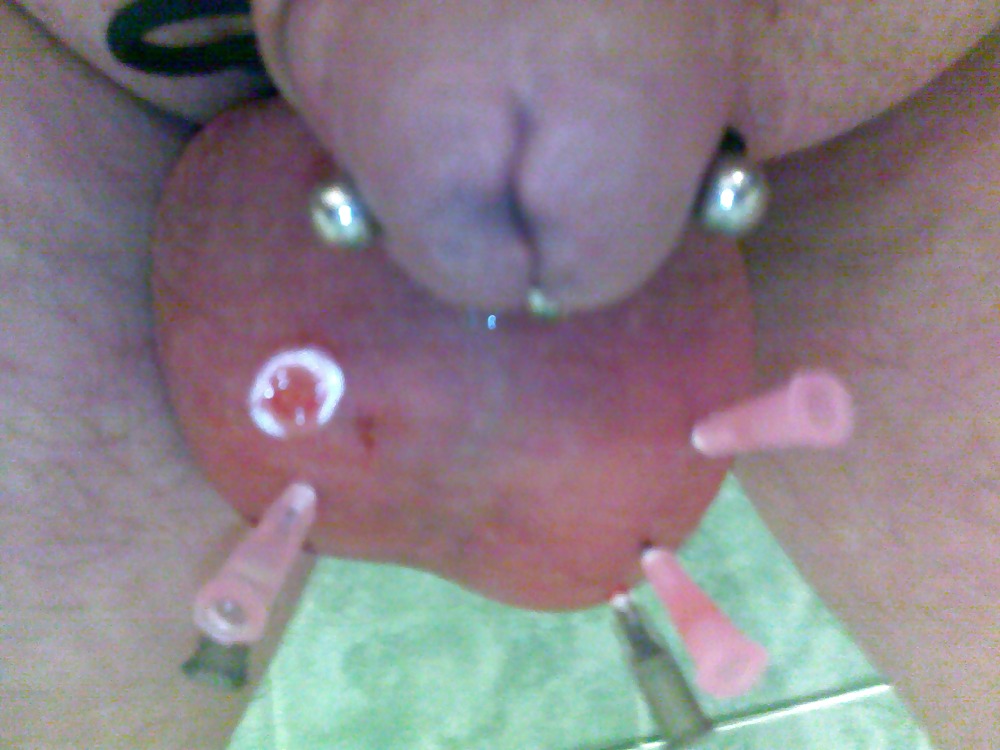 Watch Penis saline injection 2 - 3 Pics at xHamster.com! 