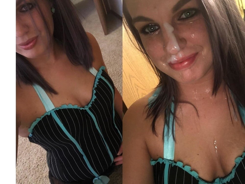 Before and After Facial Friday edition - 25 Photos 