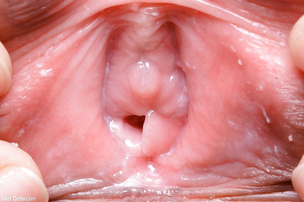 What Does A Normal Vagina Look Like, Anyway