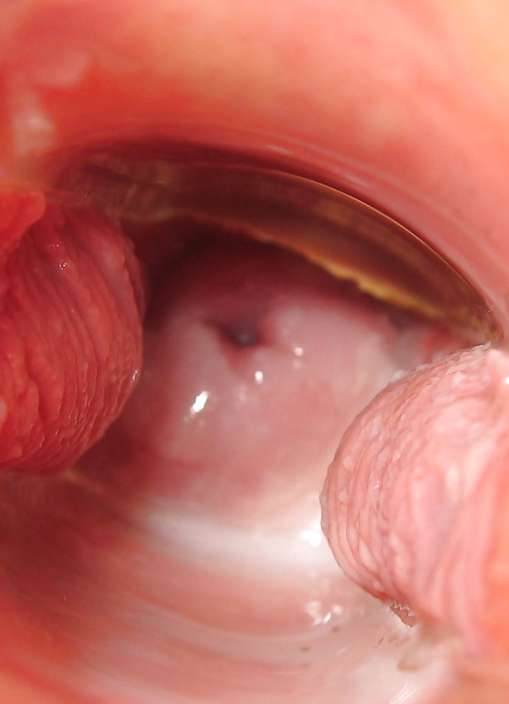 Porn image my wife's cervix