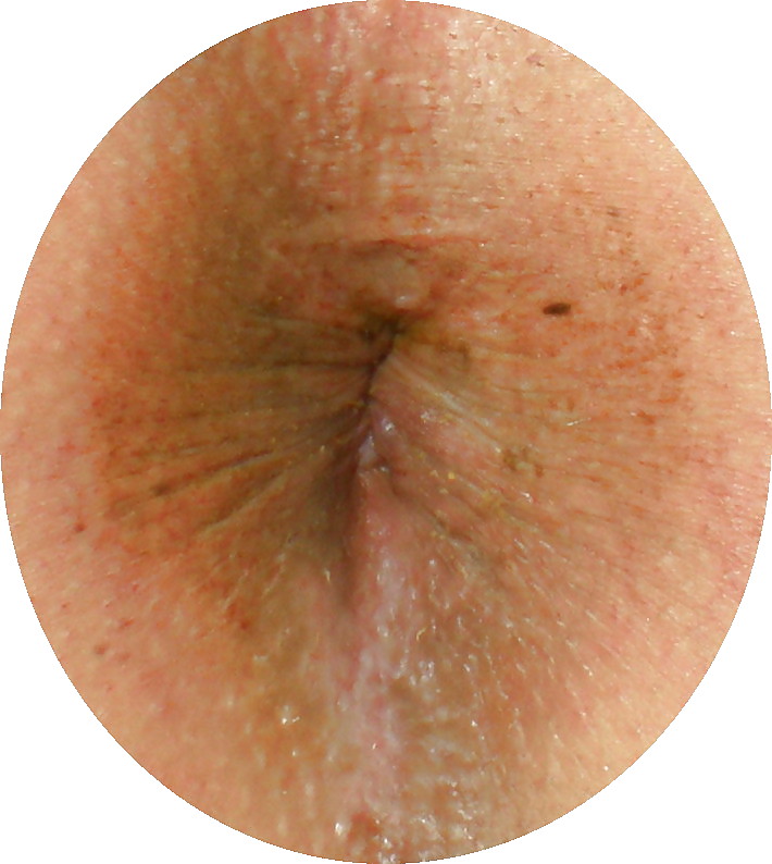 Porn image My girlie butthole as 18 years and 2 month old