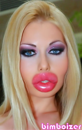 Botox Lips Porn - Big botox lips - 22 Pics | xHamster